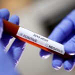 Faisal Edhi’s Son Tested for Covid-19 Covid-19 Test