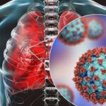 WATCH: How Coronavirus Affects Your Lungs Coronavirus Affects Your Lungs
