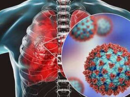 WATCH: How Coronavirus Affects Your Lungs Coronavirus Affects Your Lungs