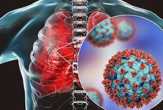 WATCH: How Coronavirus Affects Your Lungs Coronavirus Affects Your Lungs
