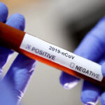 KP YDA President Tests Positive For COVID-19 KP YDA President Tests Positive For COVID-19