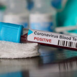 Shehbaz Sharif’s Secretary Badar Shehbaz Tests Positive for Coronavirus Badar Shehbaz Tests Positive for COVID-19