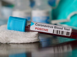 Shehbaz Sharif’s Secretary Badar Shehbaz Tests Positive for Coronavirus Badar Shehbaz Tests Positive for COVID-19