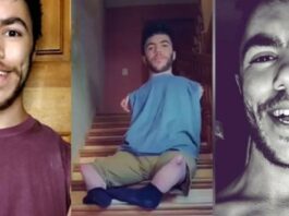 A Young Man With A Rare Congenital Disability Became A Sensational Tik-Tock Colby Van Voorhis TikToker
