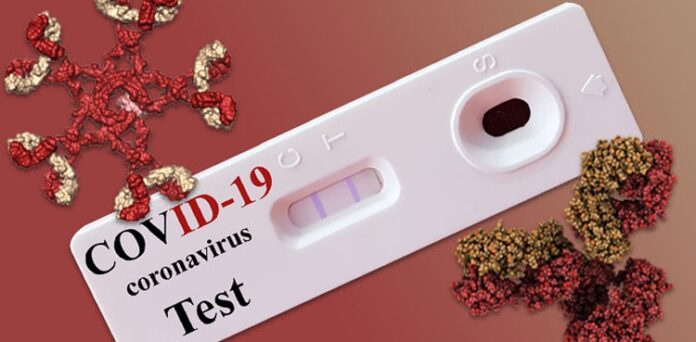 Covid-19 Test in Sindh