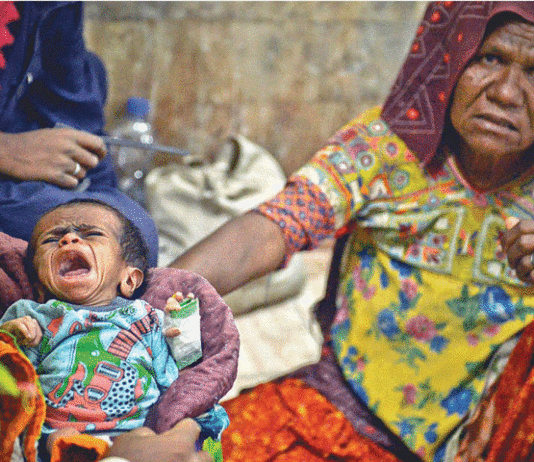 Three More Children Died of Malnutrition And Epidemics in Thar Malnutrition And Epidemic in Thar Parkar District of Sindh
