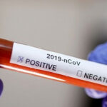 539 new coronavirus cases, 15 deaths in the last 24 hours 539 new coronavirus cases, 15 deaths in the last 24 hours