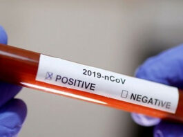 539 new coronavirus cases, 15 deaths in the last 24 hours 539 new coronavirus cases, 15 deaths in the last 24 hours