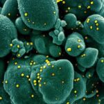 Health experts oppose easing lockdown Health experts oppose easing lockdown