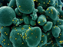 Health experts oppose easing lockdown Health experts oppose easing lockdown